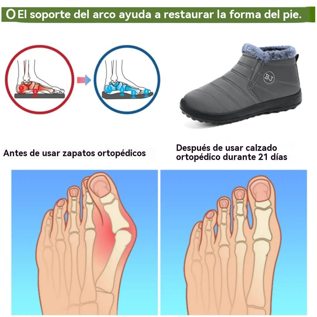 Botas ortopédicas de gamuza italiana de lujo Optimumto®: antideslizantes y cálidas, imprescindibles para la nieve. 👍Dígale adiós al dolor de pies.