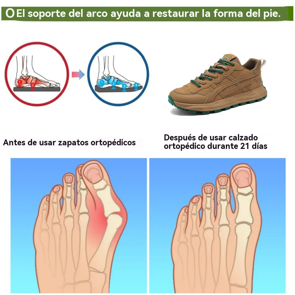 Coesses® | Nuevo producto en el mercado, a mitad de precio por tiempo limitado. Diseño ergonómico, excelente amortiguación y corrección de la marcha.