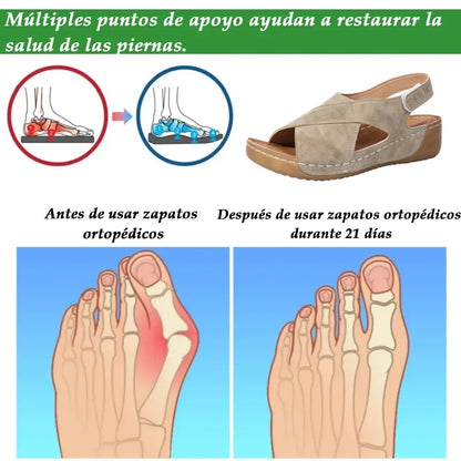 ⏰️¡No te pierdas nuestro 50% de descuento! ✅ Sandalias de alta calidad 🦶 Nuevo modelo de verano: impermeables y antideslizantes 🔴 ligeras y elegantes, adecuadas para cualquier ocasión.