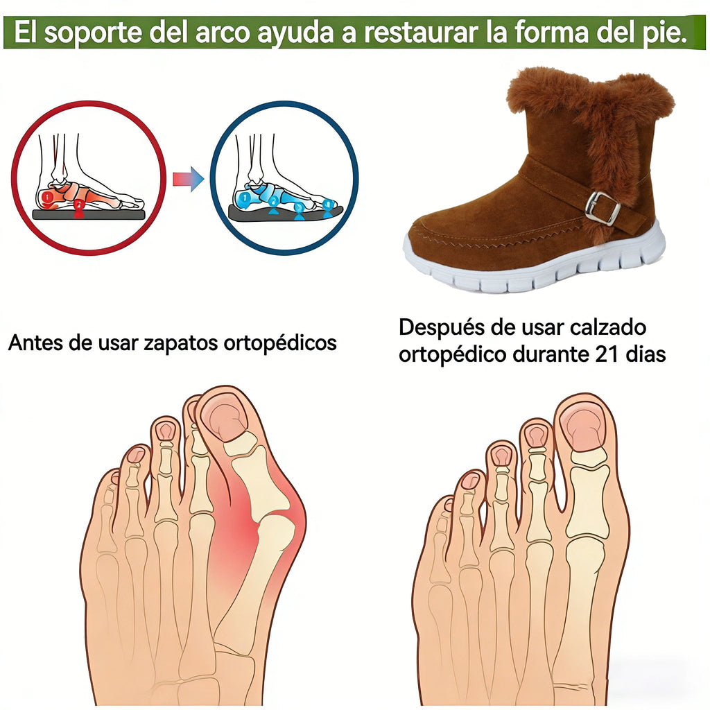 OPTIMUMTO®| Botas de nieve con forro de lana | Soporte ergonómico para el arco del pie | Alivio del dolor