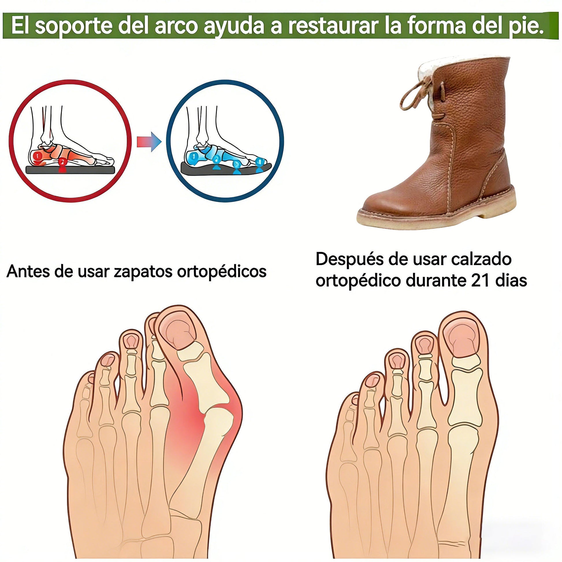 Zapatos ortopédicos Optimumto® | Cuero premium 👞Cosidos a mano