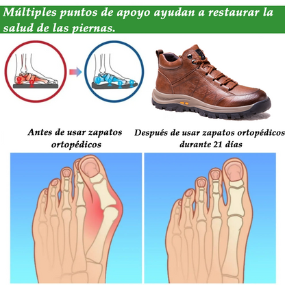 (🔥50% de descuento hoy - ¡no te lo pierdas!) - Zapatos de piel de becerro italiana suaves y cómodos - soporte de arco para aliviar el dolor (también disponible en felpa 🔥)
