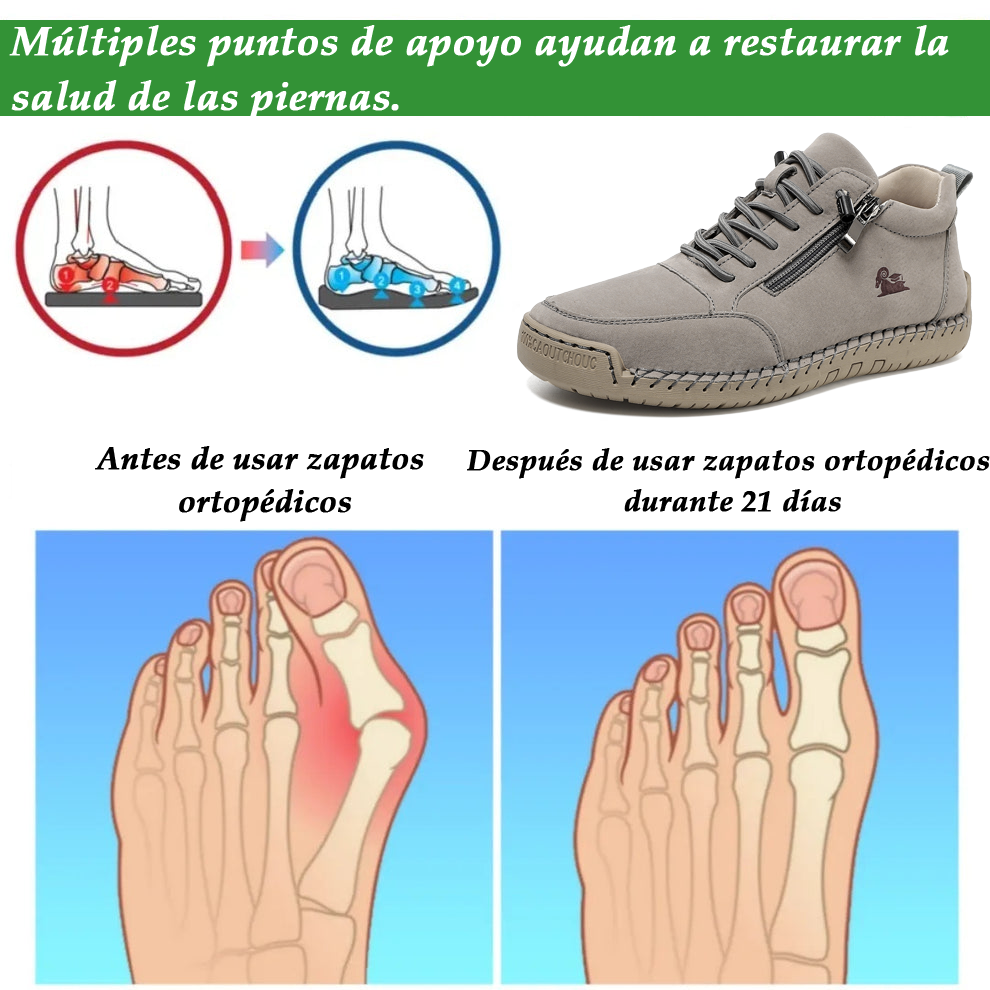 🔥 50% de descuento | OPTIMUMTO® | Zapatos ortopédicos de piel de becerro seleccionados | Antideslizantes e impermeables | Soporte de arco para aliviar el dolor