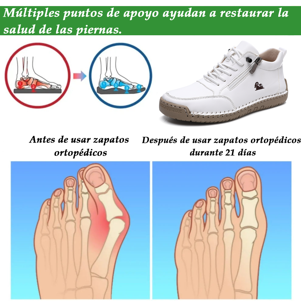 (🔥 50% de descuento - ¡No te lo pierdas!) Zapatos de piel de becerro seleccionados - Zapatos ortopédicos - 👞 - Duraderos, antideslizantes e impermeables (soporte de arco, alivio del dolor, unisex)